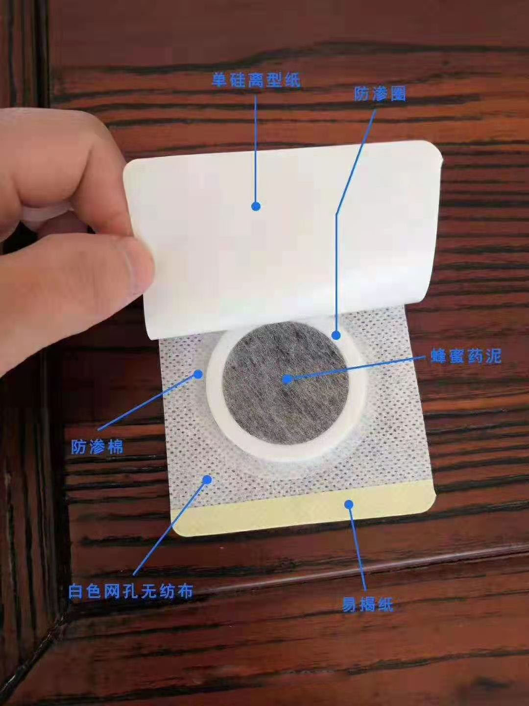 穴位壓力刺激貼。